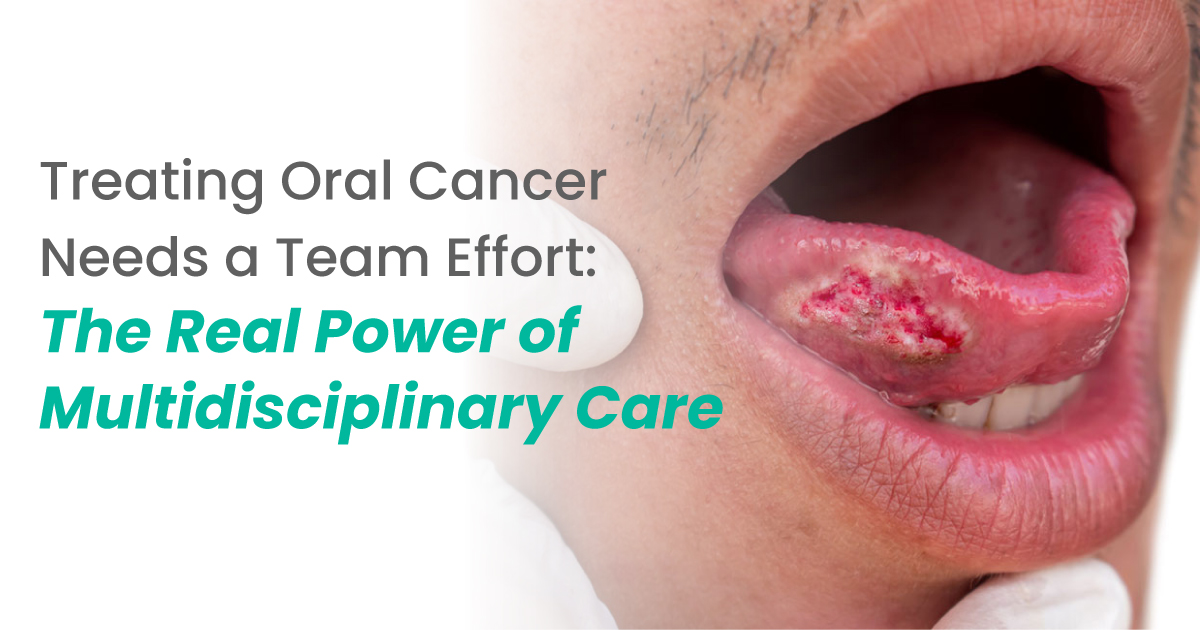 Treating Oral Cancer Needs a Team Effort: The Real Power of Multidisciplinary Care