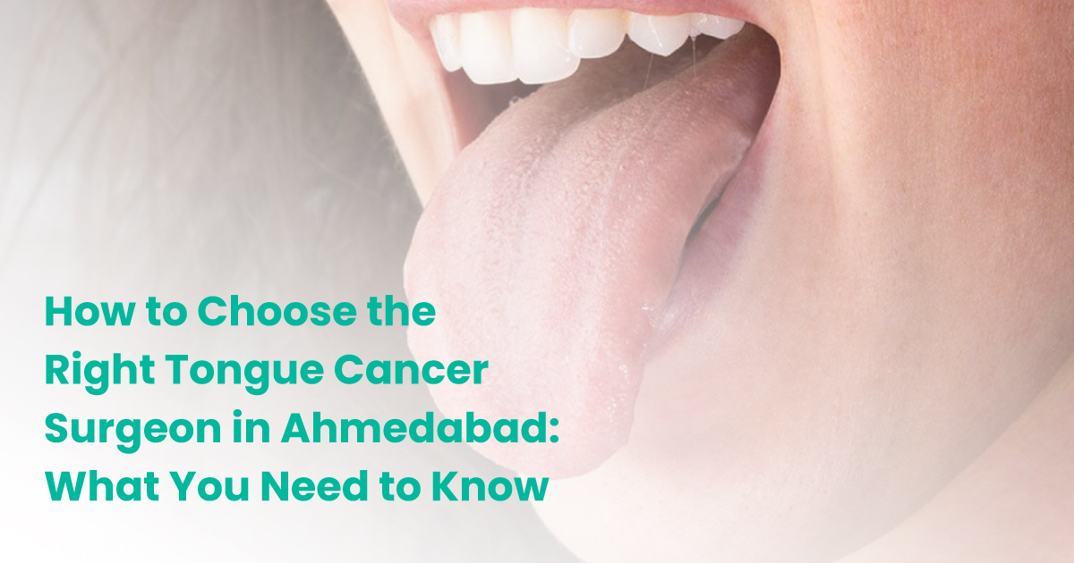 How to Choose the Right Tongue Cancer Surgeon in Ahmedabad: What You Need to Know