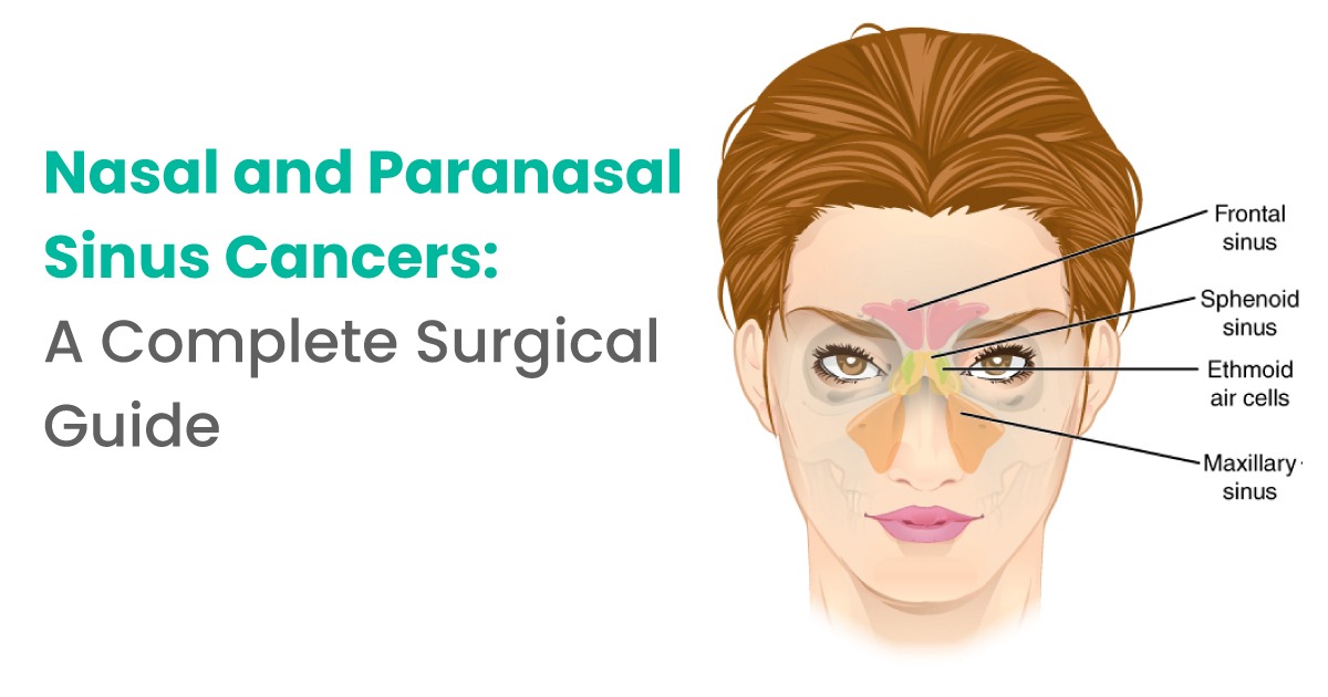 Nasal and Paranasal Sinus Cancers: A Complete Surgical Guide