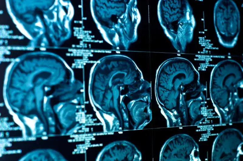 anterior_skull_base_surgeon_in_ahmedabad